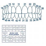 Coroane transparente cape celuloid set pt frontali adulti 64 buc - imagine 6