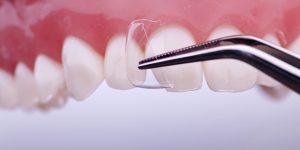 Coroane transparente cape celuloid set pt frontali adulti 64 buc - imagine 2